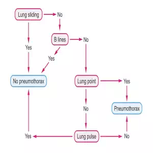 Lung US pneumothorax algorithm